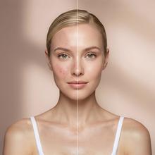 FaceCare LÜM Maschera LED per il viso con 9 colori e funzioni, infrarossi, 360 punti luce e silicone medico
