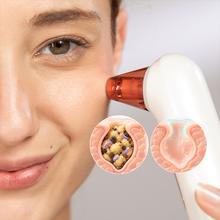 SkinCare BlackHead Remover - Succionador de Puntos Negros y Poros con Tecnología de Vacío, 3 Niveles de Succión, 4 Cabezales y Pantalla LED. Incluye Luz Azul calmante, Herramientas Manuales y Filtros HEPA