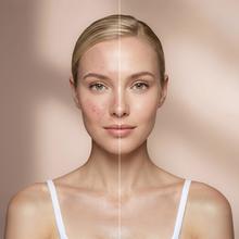 FaceCare LÜM Ice Mascara LED facial con 9 colores y funcionalidades, infrarrojos, 448 puntos de luz y silicona médica, IceTech, 210 mins de autonomía.