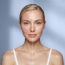 FaceCare LÜM Champagne Mascara LED facial con 9 colores y funcionalidades, infrarrojos, 360 puntos de luz y silicona médica