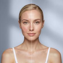FaceCare LÜM Ice Champagne Mascara LED facial con 9 colores y funcionalidades, infrarrojos, 448 puntos de luz y silicona médica, IceTech, 210 mins de autonomía.